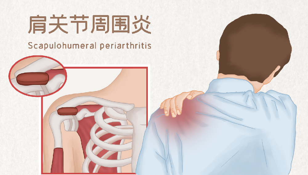 邵陽創(chuàng)傷骨科,邵陽風濕病區(qū),邵陽骨質(zhì)增生,邵陽關(guān)節(jié)病區(qū),邵陽頸椎病區(qū)